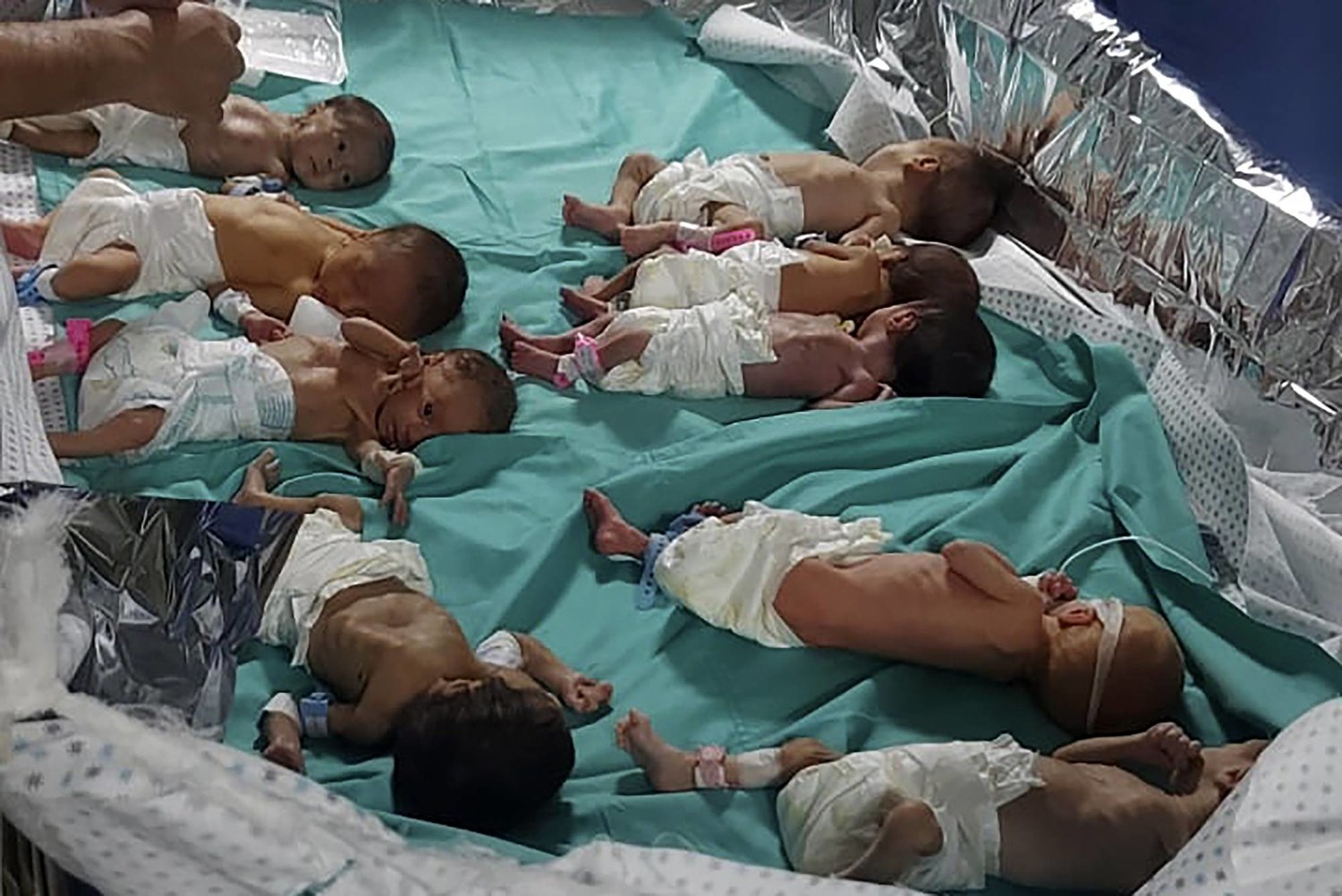 Cesáreas sin anestesia: así es parir en el infierno de Gaza